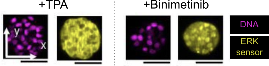 3D melanoma spheroids showing DNA and ERK sensor localisation after TPA and binimetinib treatment